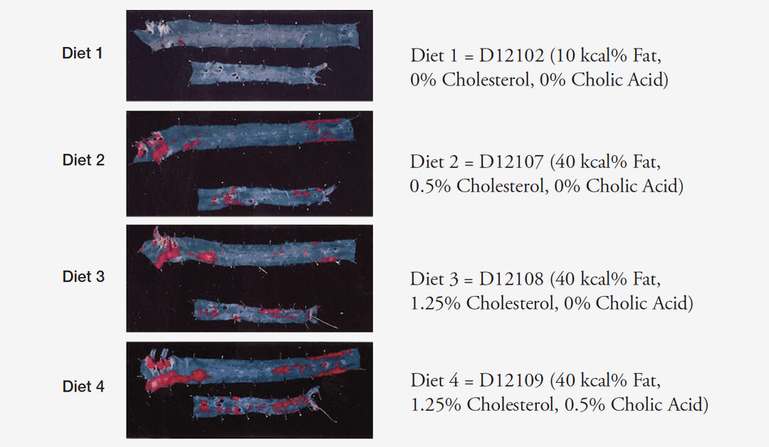 Atherosclerosis