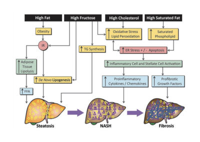 Targeted Nutrient Modifications for NAFLD